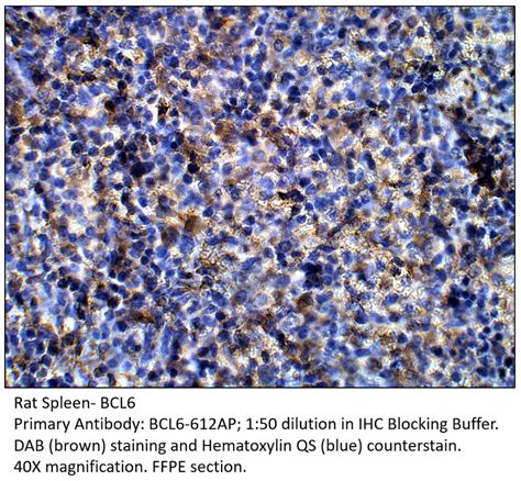 Bcl6 Antibody BCL6-612AP | FabGennix