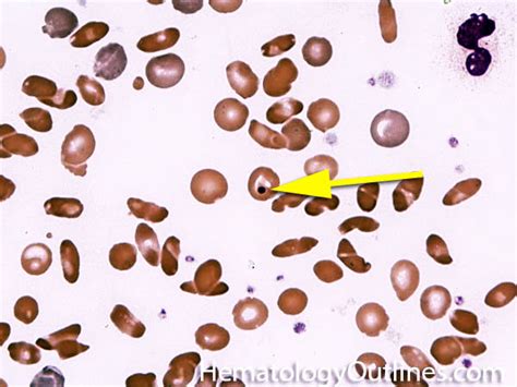 HematologyOutlines - Atlas