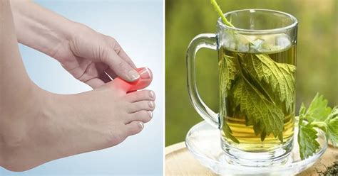 10 Natural Remedies That Can Help Alleviate Your Gout Symptoms