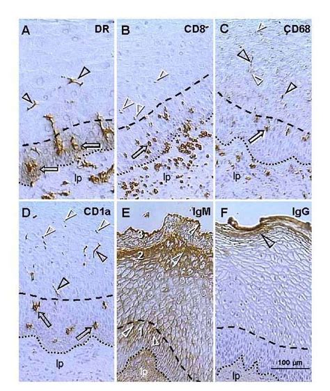 Uterine ectocervix immunohistochemistry as indicated above columns. (A)... | Download Scientific ...