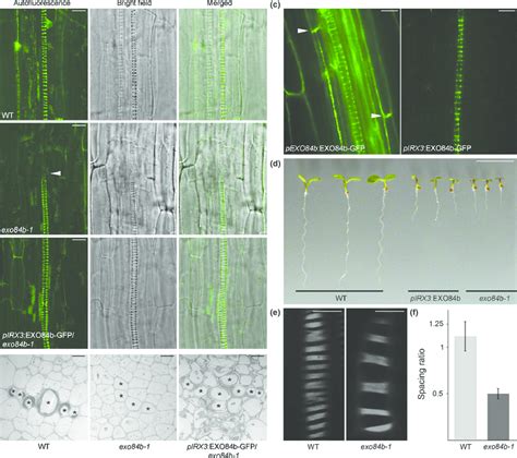 EXO84b is needed for normal protoxylem development. (a)... | Download Scientific Diagram