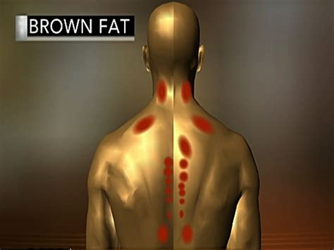 Healthy "brown fat" may reduce risk for obesity and diabetes - CBS News