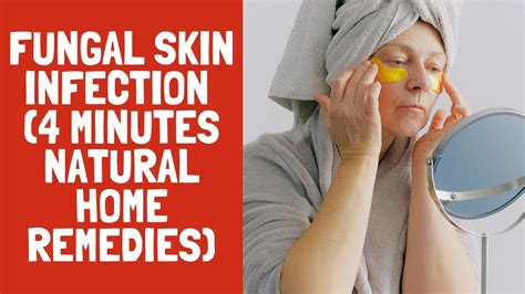 Natural remedy for fungal skin infection (4 minutes natural home ...