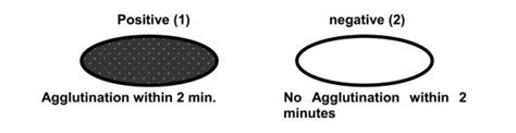 Antistreptolysin O titer | Medical Laboratories