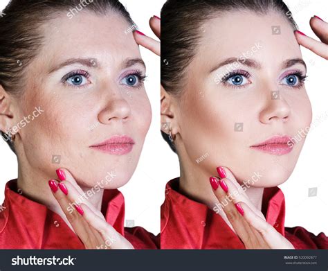 Woman Before And After Cosmetic Procedure Stock Photo 520092877 : Shutterstock