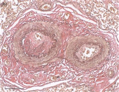 Histological examination of small pulmonary arteries stained with (a)... | Download Scientific ...