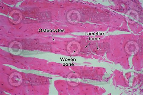 Mammal. Joint. Transverse section. 250X - Woven bone - Bone - Connective tissue - Animal tissues ...