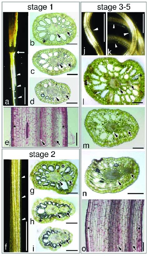 | Anatomy of Vallisneria female flower peduncle. | Download Scientific ...