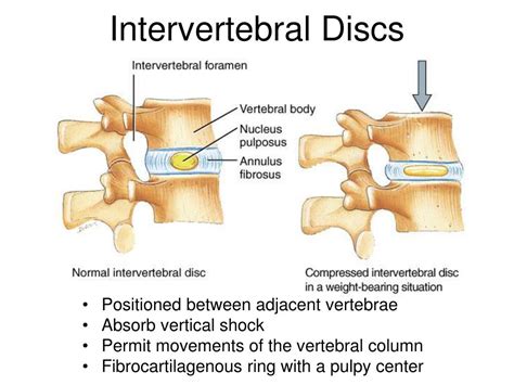 PPT - Lab05 Vertebrae Ribs and rib articulation Sternum Skull Review PowerPoint Presentation ...