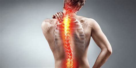 A Patient's Guide to Scoliosis Surgery | Advanced Spine Care