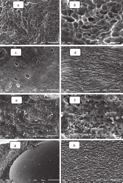 Different representative bone graft materials as seen under SEM. (a ...