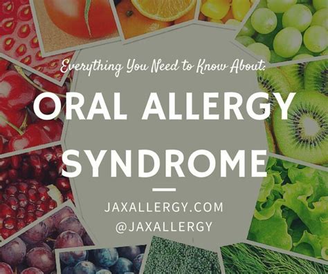 Oral Allergy Syndrome—What You Need to Know