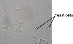 Yeast Cells Budding