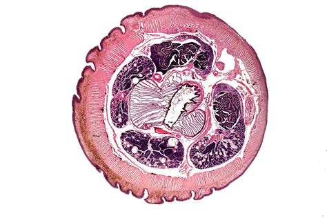 Earthworm, Transverse Section Photograph by Dr Keith Wheeler