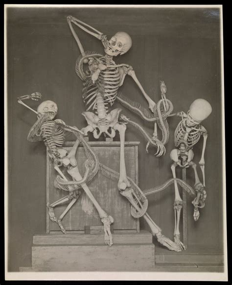 Three human skeletons displayed with a snake skeleton, representing ...