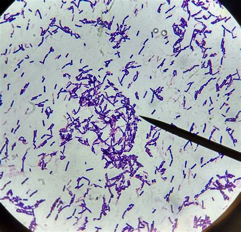 Bacillus. Large gram positive rod-shaped bacteria.