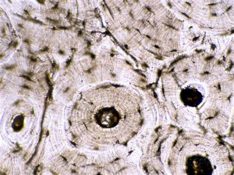 'Compact Bone Skeletal Sys. Photomicrograph X100' Photographic Print ...