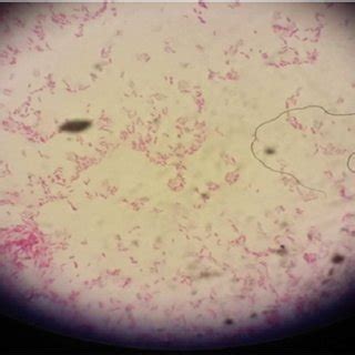 Gram's stain of Legionella pneumophila. | Download Scientific Diagram