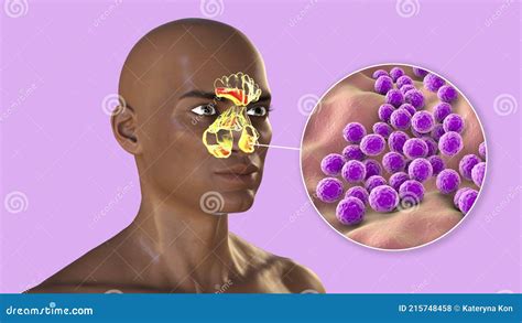 Staphylococcus Aureus Structure