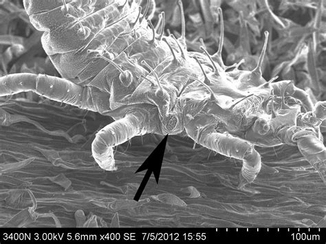 Scanning Electron Microscope Blog: An unexpected bonus - a thrip larva