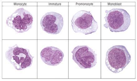 Monocyte morphology and maturation | Hematology, Medical laboratory ...