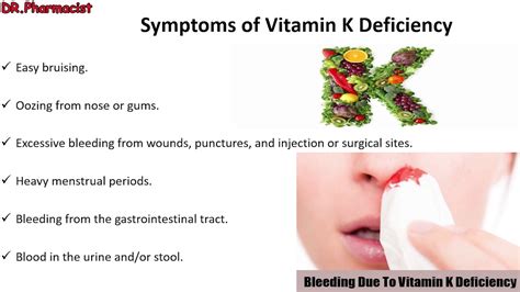 Symptoms of Vitamin K Deficiency - YouTube