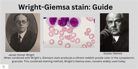 Wright-Giemsa stain procedure, principle, and results