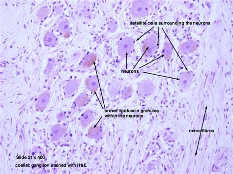 64 best Histology - Spinal Cord and Ganglion images on Pinterest | Spinal cord, Cross section ...