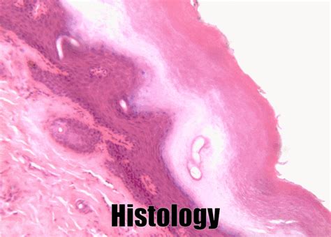 Histology of the oral mucosa – Histology and Embryology for Dental Hygiene