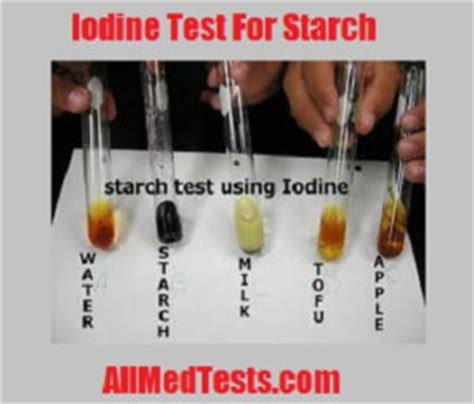 Iodine test for Starch- Its Principle, Reagents, Procedure etc