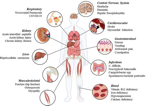 Cureus | Adverse Effects Associated with Proton Pump Inhibitor Use