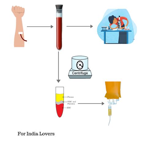 Convalescent Plasma Therapy - A stoppage measure for COVID 19 - For India Lovers