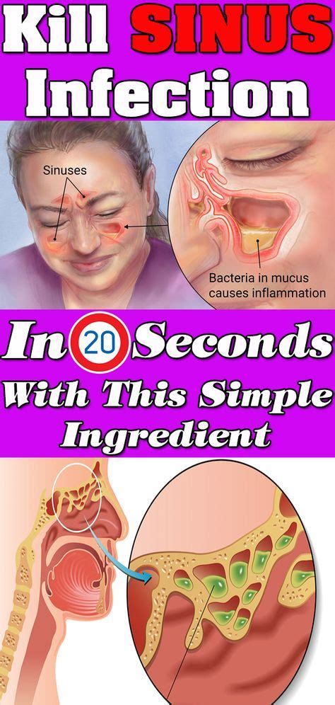 KILL SINUS INFECTION IN 20 SECONDS WITH THIS SIMPLE METHOD AND THIS COMMON HOUSEHOLD INGREDIENT ...