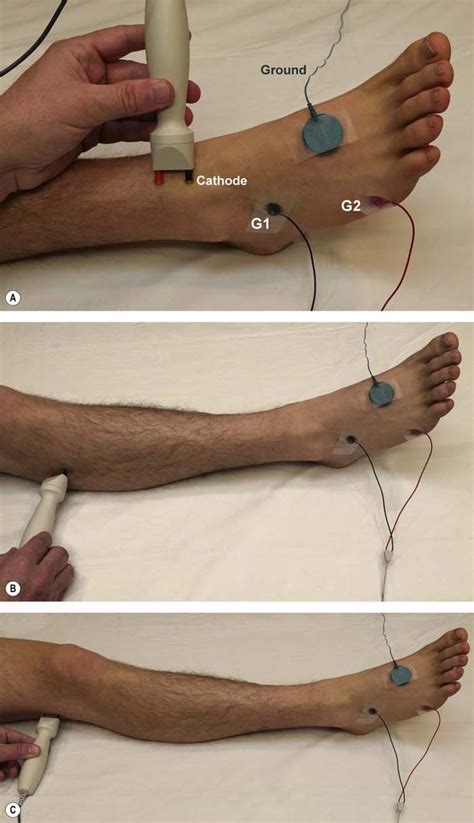 Nerve Conduction Study Video