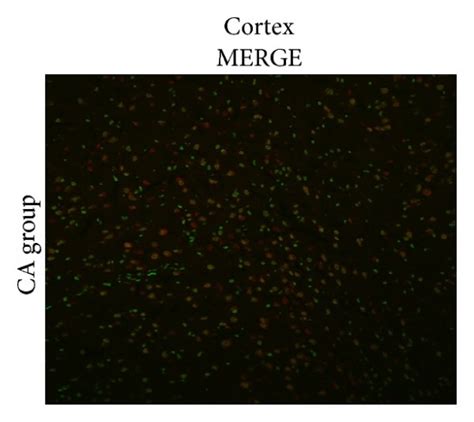 Representative photomicrographs show immunofluorescent staining for... | Download Scientific Diagram