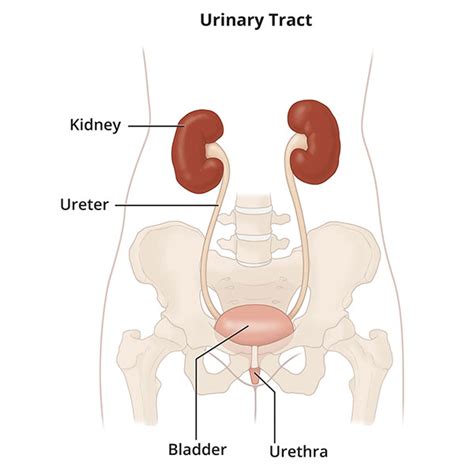 Interstitial Cystitis (Painful Bladder Syndrome) - NIDDK