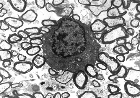 Oligodendrocyte Histology