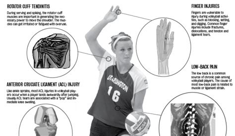 Volleyball Injuries | | theshorthorn.com