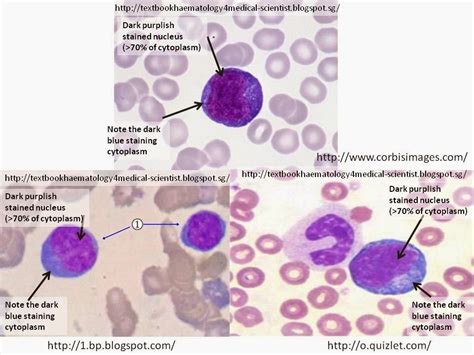 Haematology in a NutShell: Reactive/Atypical Lymphocytes