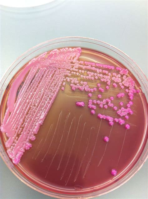 Klebsiella on MacConkey. Enterobacteriaceae | Medical laboratory, Microbiology, Microbiology lab