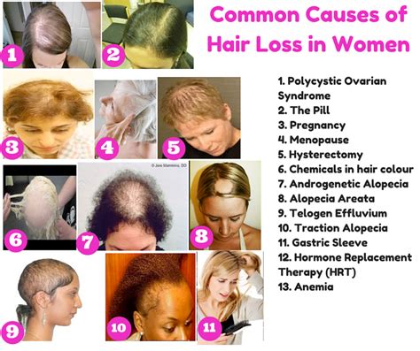 What Cause Hair Loss In Women