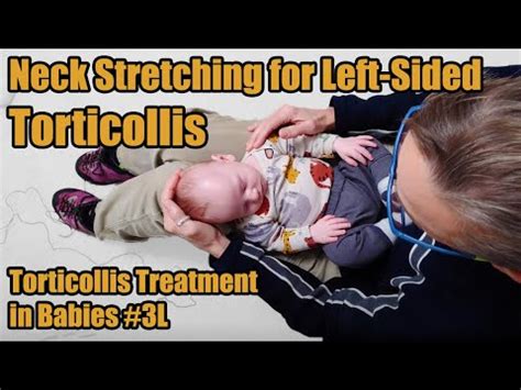 #3L Neck Stretches for Left-sided Torticollis: Torticollis Treatment in ...