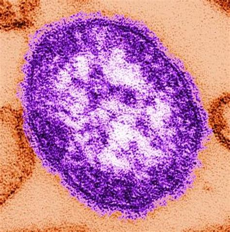 Measles outbreak in New York City has ended | MDedge Pediatrics