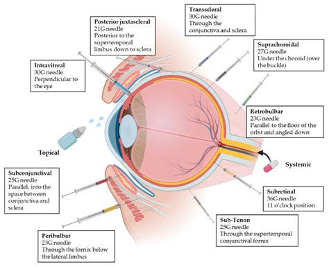 Lipid Nanoparticles for the Posterior Eye Segment - Pharma Excipients