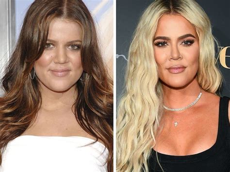 Khloé Kardashian Plastic Surgeries - Milano Klinik