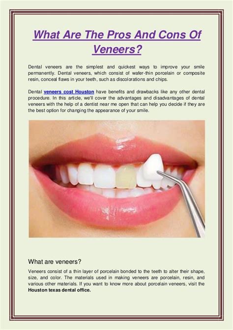 What Are The Pros And Cons Of Veneers.pdf