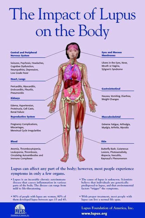 45 Best Connective Tissue Disease images in 2019 | Rheumatoid arthritis, Autoimmune disease ...