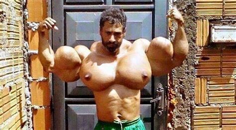 Bodybuilder Blows Arms Out With Oil Injections