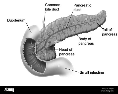 Normal Pancreas And Pancreatic Duct Pancreas Case