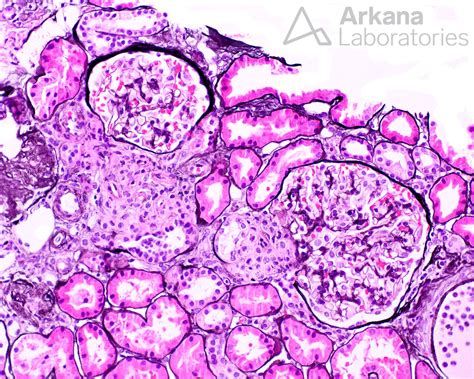 Juxtaglomerular Apparatus Histology